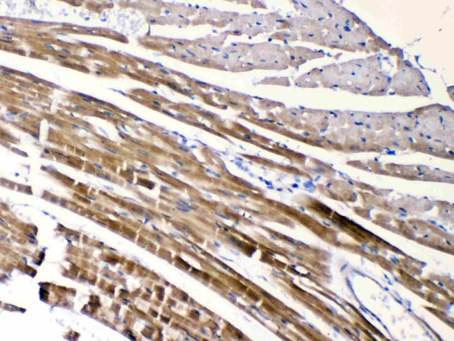 CHRNA5 Antibody in Immunohistochemistry (Paraffin) (IHC (P))