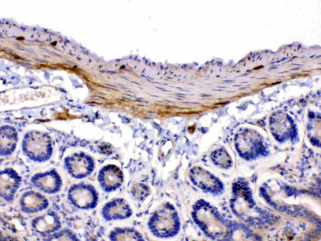 CHRNA5 Antibody in Immunohistochemistry (Paraffin) (IHC (P))