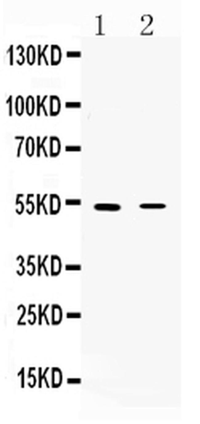 CHRNA5 Antibody in Western Blot (WB)