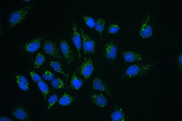 CLPX Antibody in Immunocytochemistry (ICC/IF)