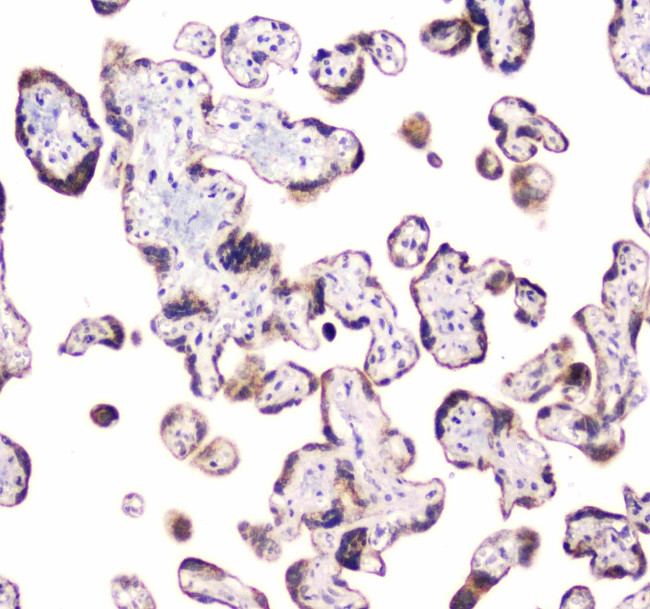 CLPX Antibody in Immunohistochemistry (Paraffin) (IHC (P))