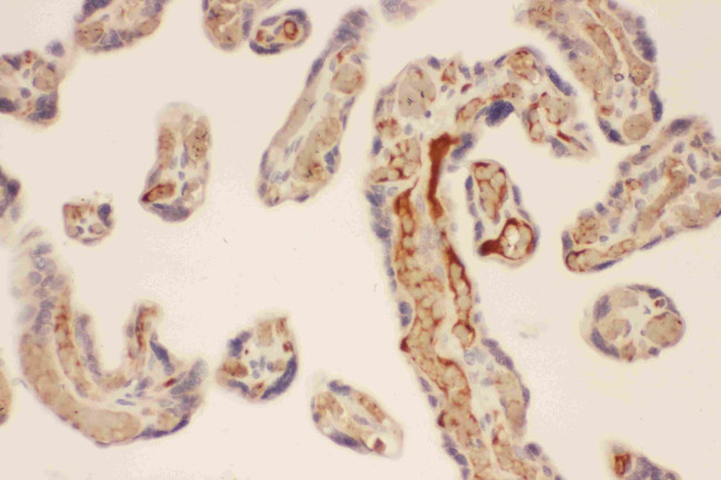 Mast Cell Chymase Antibody in Immunohistochemistry (Paraffin) (IHC (P))