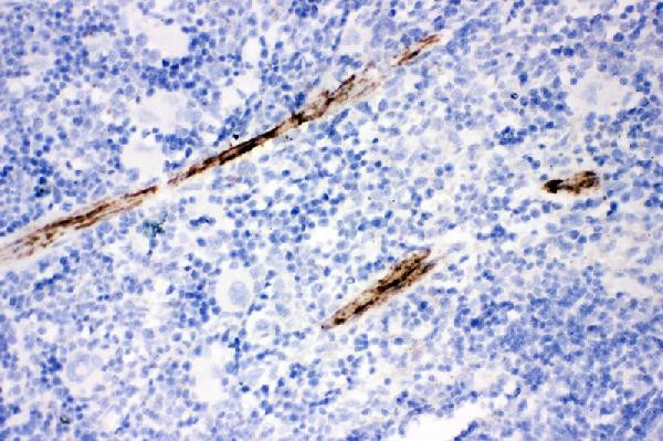 Calponin 1 Antibody in Immunohistochemistry (Paraffin) (IHC (P))