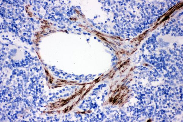 Calponin 1 Antibody in Immunohistochemistry (Paraffin) (IHC (P))