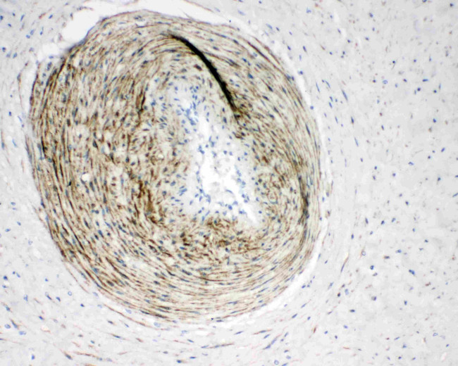 Calponin 1 Antibody in Immunohistochemistry (Paraffin) (IHC (P))