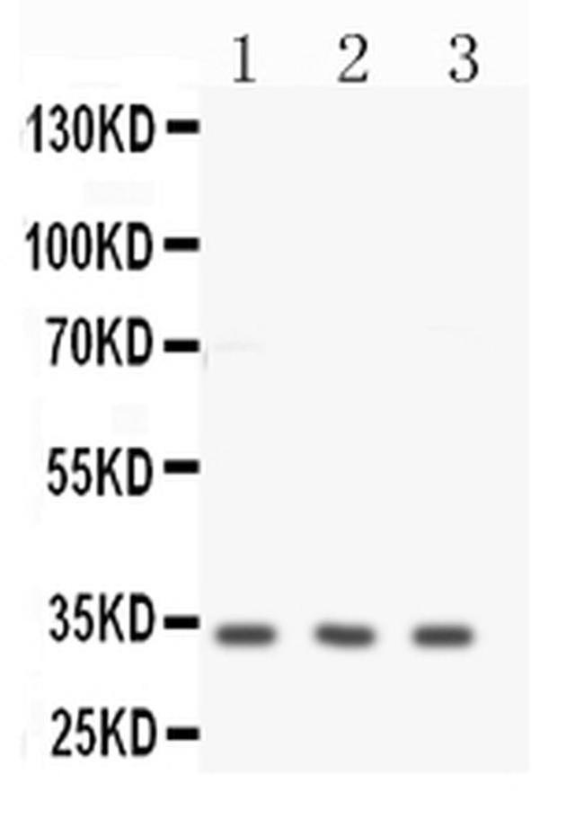 Calponin 1 Antibody in Western Blot (WB)