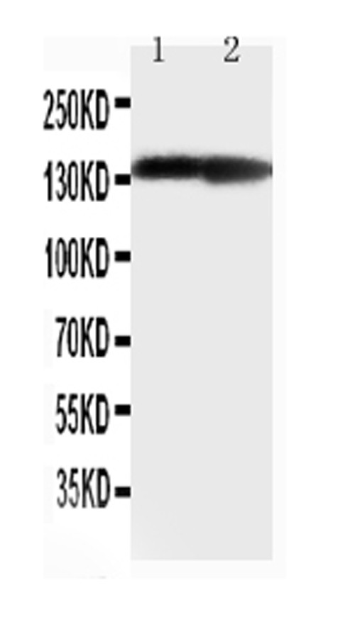 Collagen II Antibody in Western Blot (WB)