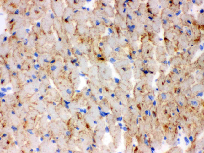 CPT1B Antibody in Immunohistochemistry (Frozen) (IHC (F))