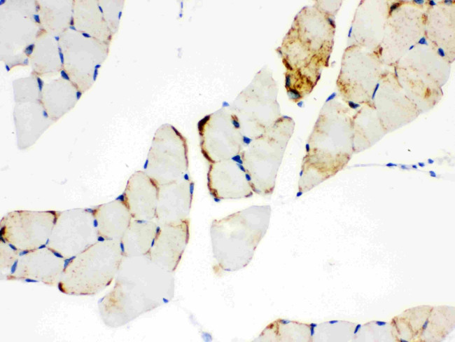 CPT1B Antibody in Immunohistochemistry (Paraffin) (IHC (P))