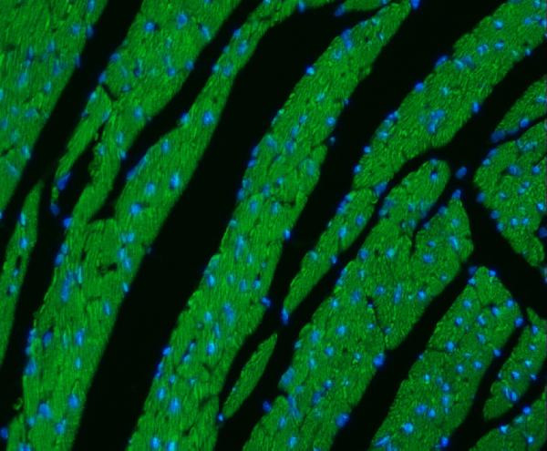 CPT1B Antibody in Immunohistochemistry (Paraffin) (IHC (P))