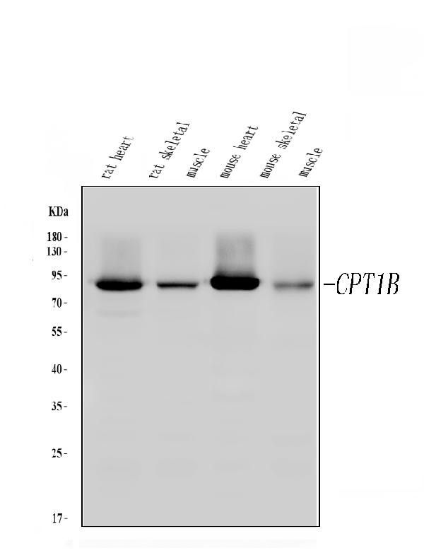 CPT1B Antibody in Western Blot (WB)