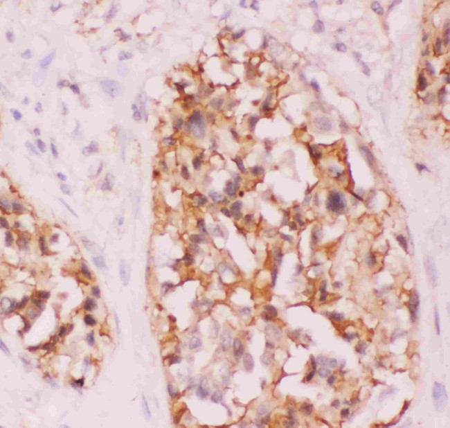 CRK Antibody in Immunohistochemistry (Paraffin) (IHC (P))