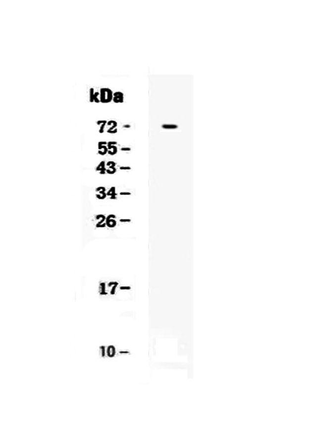 TSLP Receptor Antibody in Western Blot (WB)