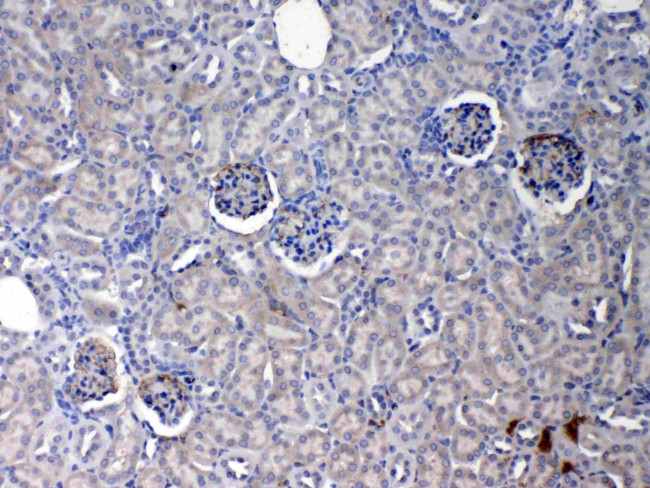 CRP Antibody in Immunohistochemistry (Paraffin) (IHC (P))