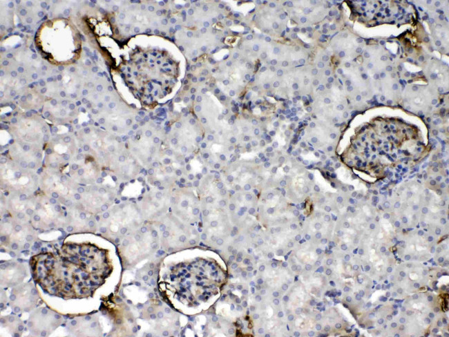 CRP Antibody in Immunohistochemistry (Paraffin) (IHC (P))