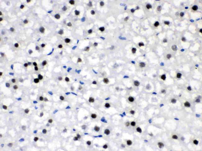 CRY2 Antibody in Immunohistochemistry (Paraffin) (IHC (P))