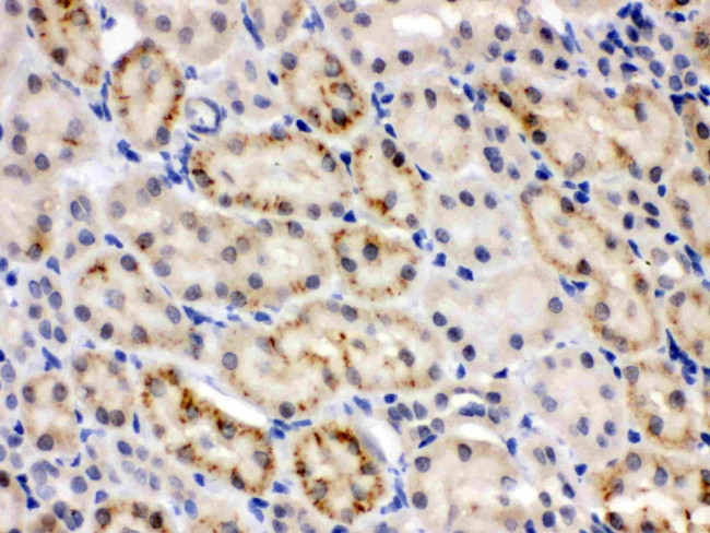 CRY2 Antibody in Immunohistochemistry (Paraffin) (IHC (P))