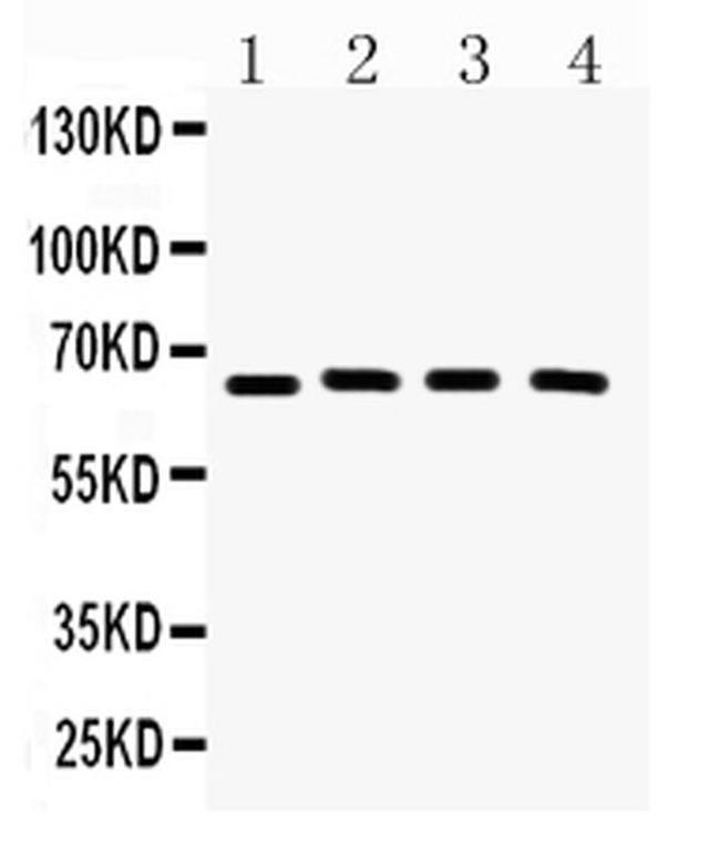 CRY2 Antibody in Western Blot (WB)