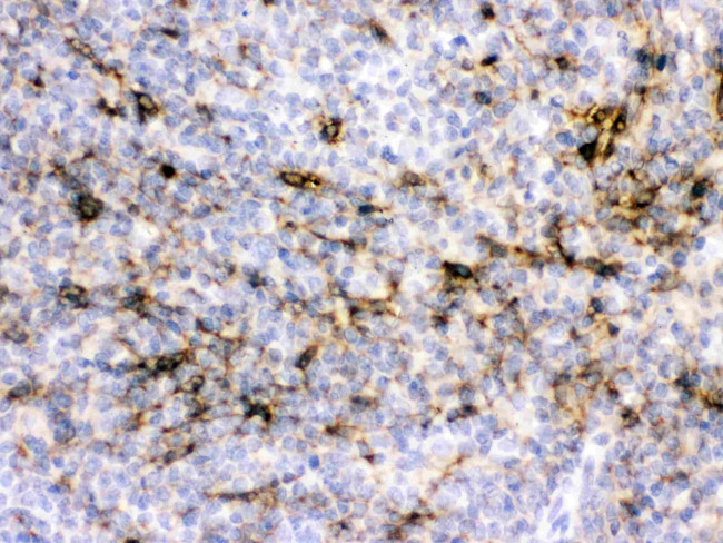 Alpha A Crystallin Antibody in Immunohistochemistry (Paraffin) (IHC (P))