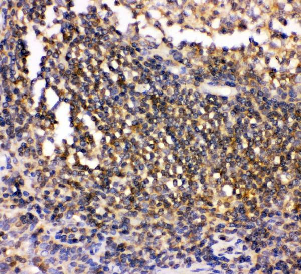 CSK Antibody in Immunohistochemistry (Paraffin) (IHC (P))