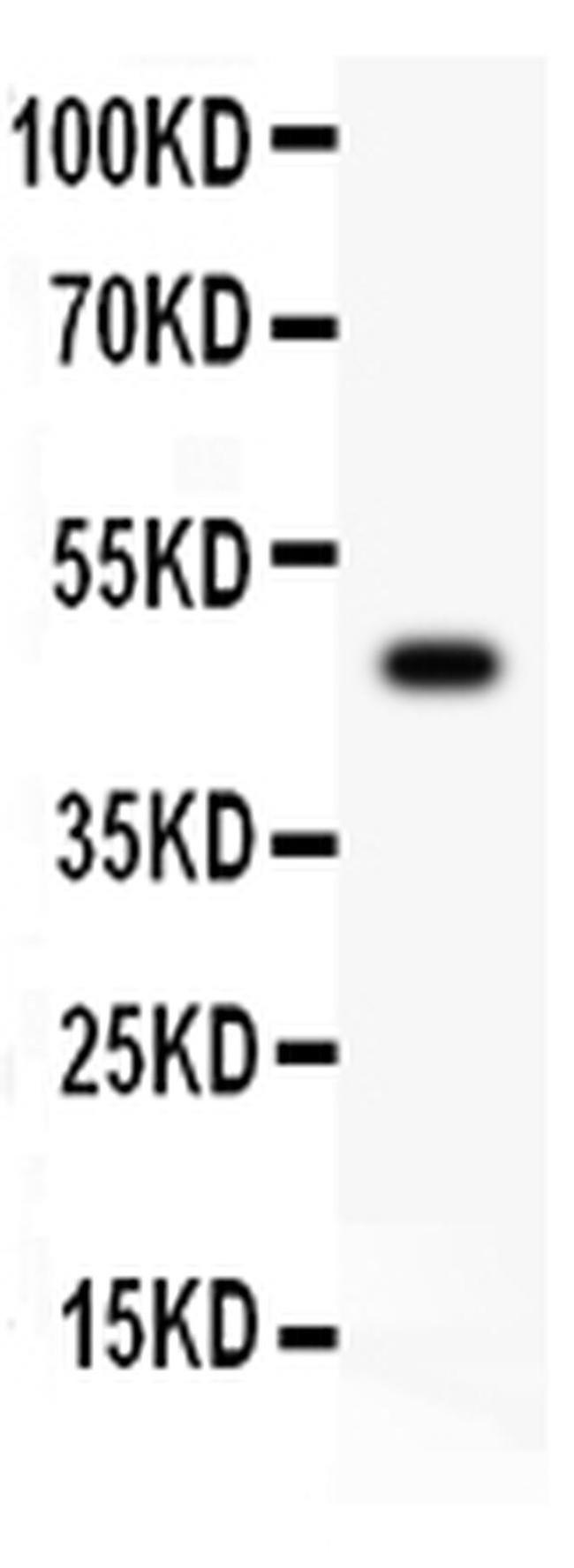 CSK Antibody in Western Blot (WB)