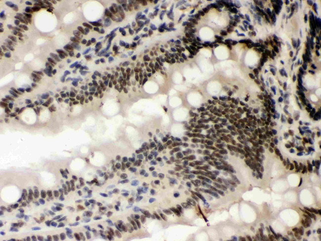 CK1 alpha Antibody in Immunohistochemistry (Paraffin) (IHC (P))