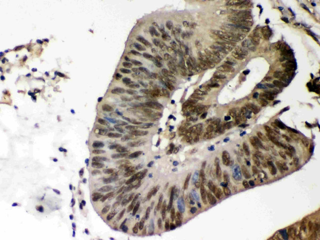 CK1 alpha Antibody in Immunohistochemistry (Paraffin) (IHC (P))