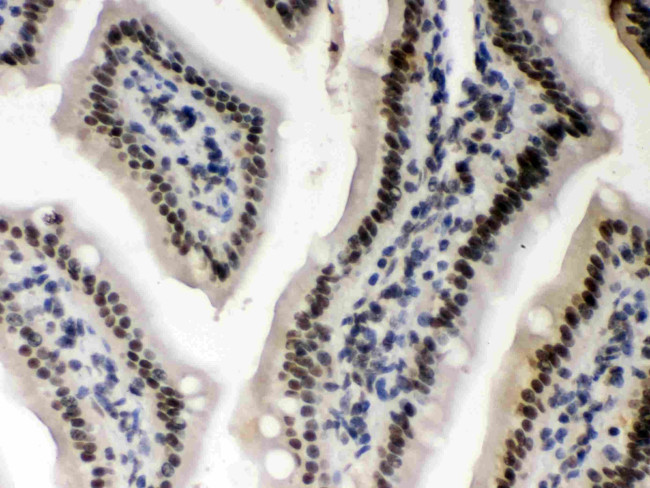 CK1 alpha Antibody in Immunohistochemistry (Paraffin) (IHC (P))