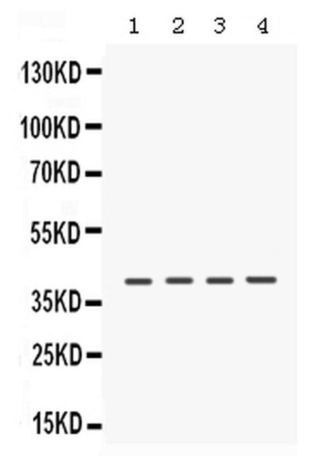 CK1 alpha Antibody in Western Blot (WB)