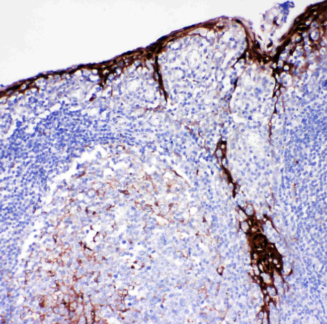 Cystatin A Antibody in Immunohistochemistry (Paraffin) (IHC (P))