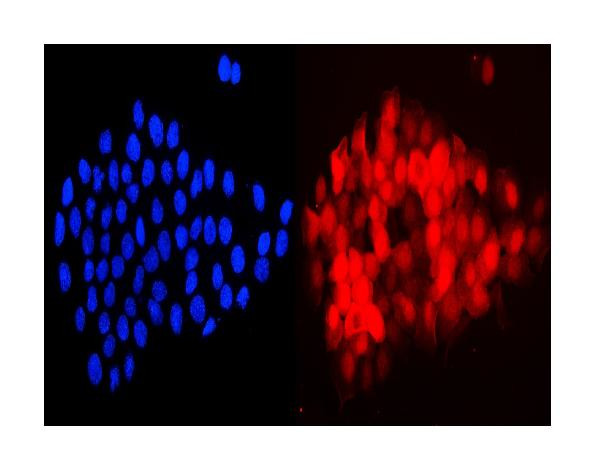 Cystatin A Antibody in Immunocytochemistry (ICC/IF)