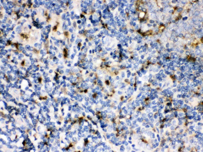 Cystatin A Antibody in Immunohistochemistry (Paraffin) (IHC (P))