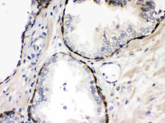 Cystatin B Antibody in Immunohistochemistry (Paraffin) (IHC (P))