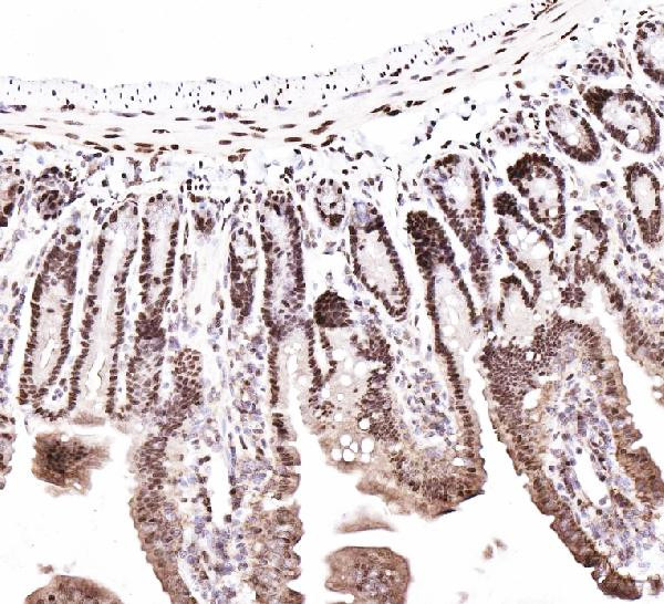 CtBP2 Antibody in Immunohistochemistry (Paraffin) (IHC (P))