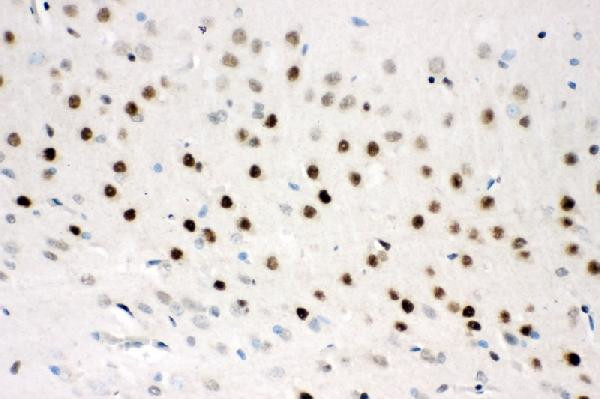 CtBP2 Antibody in Immunohistochemistry (Paraffin) (IHC (P))