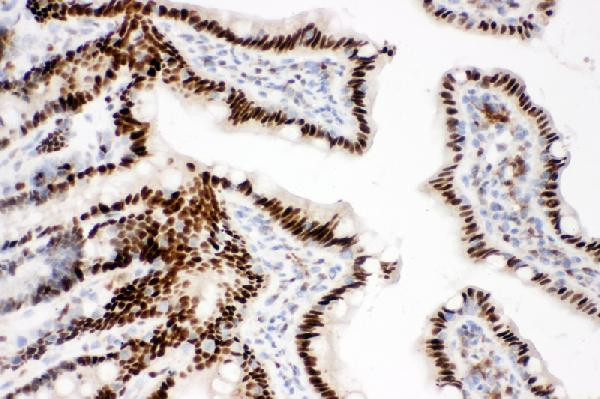 CtBP2 Antibody in Immunohistochemistry (Paraffin) (IHC (P))