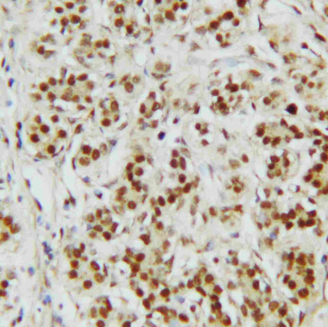 CtBP2 Antibody in Immunohistochemistry (Paraffin) (IHC (P))