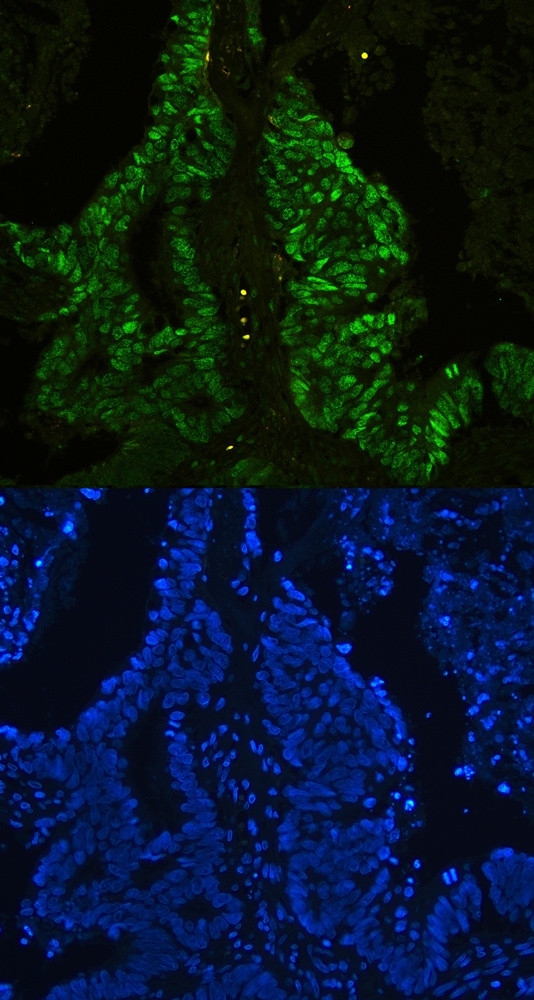 CtBP2 Antibody in Immunohistochemistry (Paraffin) (IHC (P))