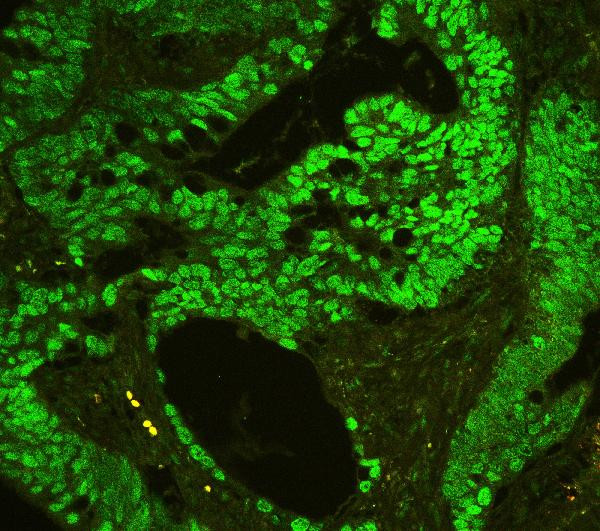 CtBP2 Antibody in Immunohistochemistry (Paraffin) (IHC (P))