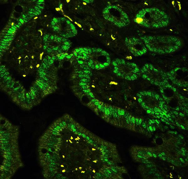 CtBP2 Antibody in Immunohistochemistry (Paraffin) (IHC (P))