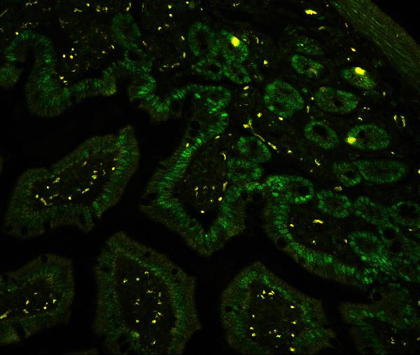 CtBP2 Antibody in Immunohistochemistry (Paraffin) (IHC (P))