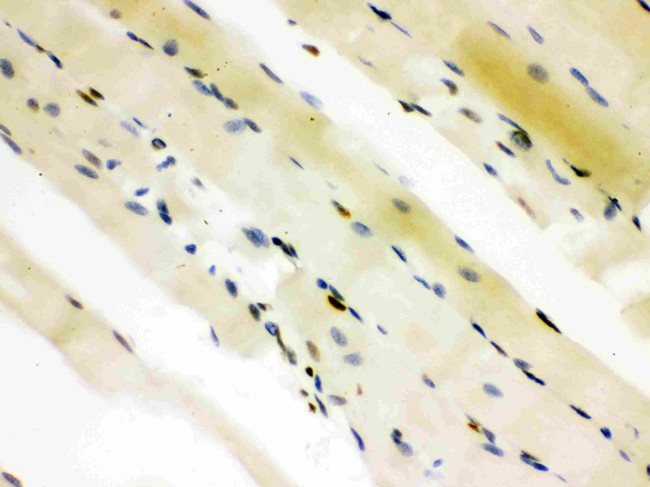 CtBP2 Antibody in Immunohistochemistry (Paraffin) (IHC (P))