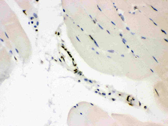 CtBP2 Antibody in Immunohistochemistry (Paraffin) (IHC (P))