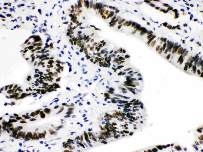 CtBP2 Antibody in Immunohistochemistry (Paraffin) (IHC (P))