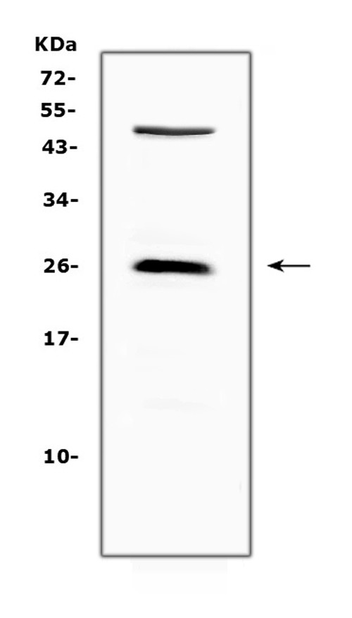 CTLA-4 (CD152) Antibody in Western Blot (WB)