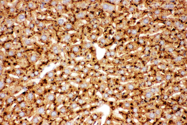 Cathepsin D Antibody in Immunohistochemistry (Paraffin) (IHC (P))