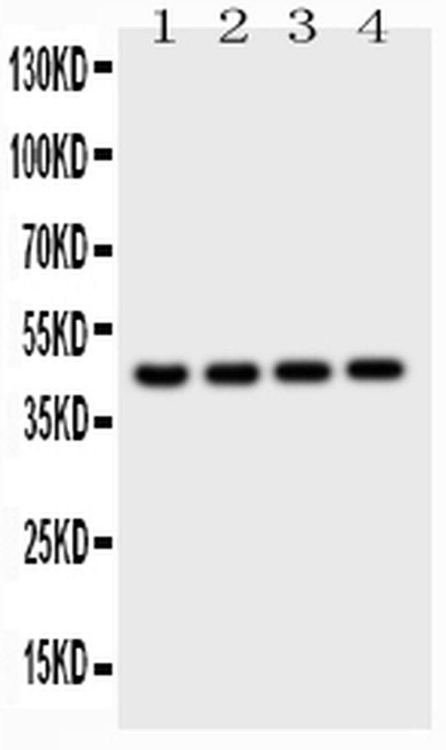 Cathepsin D Antibody in Western Blot (WB)