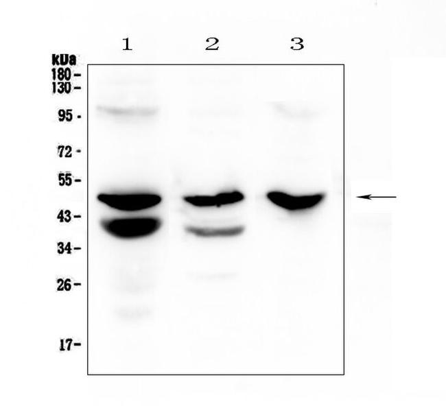 Cathepsin E Antibody in Western Blot (WB)