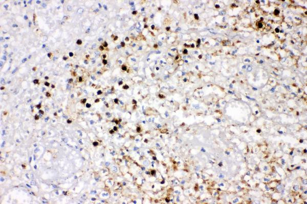 IL-8 (CXCL8) Antibody in Immunohistochemistry (Paraffin) (IHC (P))