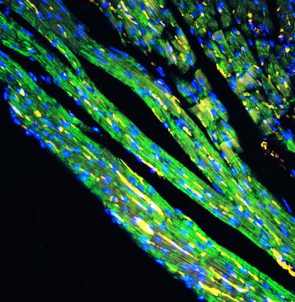 Cytochrome C Antibody in Immunohistochemistry (Paraffin) (IHC (P))